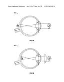 AUGMENTED AND VIRTUAL REALITY DISPLAY SYSTEMS AND METHODS FOR DELIVERY OF     MEDICATION TO EYES diagram and image