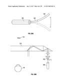 AUGMENTED AND VIRTUAL REALITY DISPLAY SYSTEMS AND METHODS FOR DELIVERY OF     MEDICATION TO EYES diagram and image