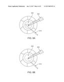 Cataract Posterior/Wedge Chopper diagram and image