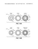 LASER ASSISTED CATARACT SURGERY diagram and image