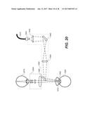 LASER ASSISTED CATARACT SURGERY diagram and image