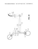 LASER ASSISTED CATARACT SURGERY diagram and image