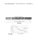 LASER ASSISTED CATARACT SURGERY diagram and image