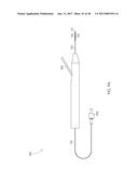 STEERABLE LASER PROBE diagram and image