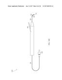 STEERABLE LASER PROBE diagram and image