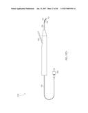 STEERABLE LASER PROBE diagram and image