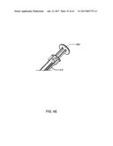 INFUSION PUMP ASSEMBLY diagram and image