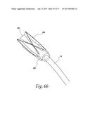 FLUSHABLE CATHETERS diagram and image