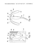 FLUSHABLE CATHETERS diagram and image