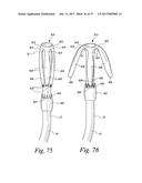 FLUSHABLE CATHETERS diagram and image