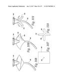 FLUSHABLE CATHETERS diagram and image