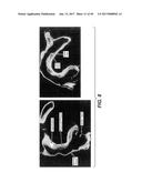 IL-22 POLYPEPTIDES AND IL-22 Fc FUSION PROTEINS AND METHODS OF USE diagram and image