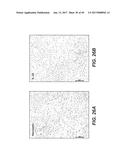 IL-22 POLYPEPTIDES AND IL-22 Fc FUSION PROTEINS AND METHODS OF USE diagram and image