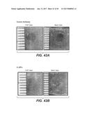 IL-22 POLYPEPTIDES AND IL-22 Fc FUSION PROTEINS AND METHODS OF USE diagram and image