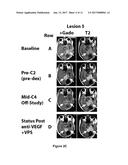 Improved Methods for the Treatment of Vascularizing Cancers diagram and image