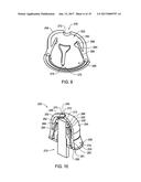 METHODS FOR USE IN COVERING A PORTION OF A FASTENER PROTRUDING FROM A     SURFACE diagram and image