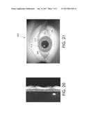 Method of Detecting Boundaries of the Human Eye diagram and image