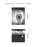 Method of Detecting Boundaries of the Human Eye diagram and image