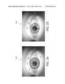 Method of Detecting Boundaries of the Human Eye diagram and image