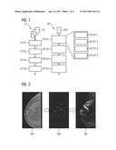 GENERATING A SYNTHETIC TWO-DIMENSIONAL MAMMOGRAM diagram and image