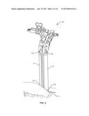 SURGICAL INSTRUMENT AND METHOD OF USE diagram and image
