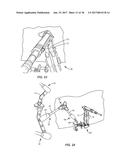 SURGICAL INSTRUMENT AND METHOD OF USE diagram and image