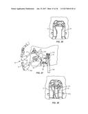 SURGICAL INSTRUMENT AND METHOD OF USE diagram and image