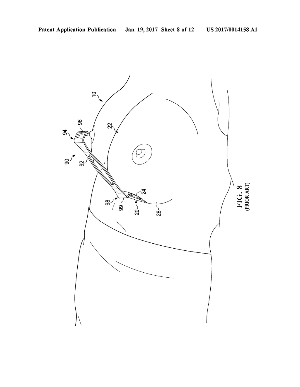 Universal Bellows - diagram, schematic, and image 09