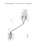 Robotic Surgery System, Method, and Apparatus diagram and image