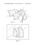 METHODS FOR PROCESSING POULTRY THIGHS TO PRODUCE WING-LIKE POULTRY PARTS diagram and image