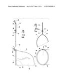 SURGICAL TISSUE RETRIEVAL INSTRUMENT AND METHOD OF USE OF A SURGICAL     TISSUE RETRIEVAL INSTRUMENT diagram and image