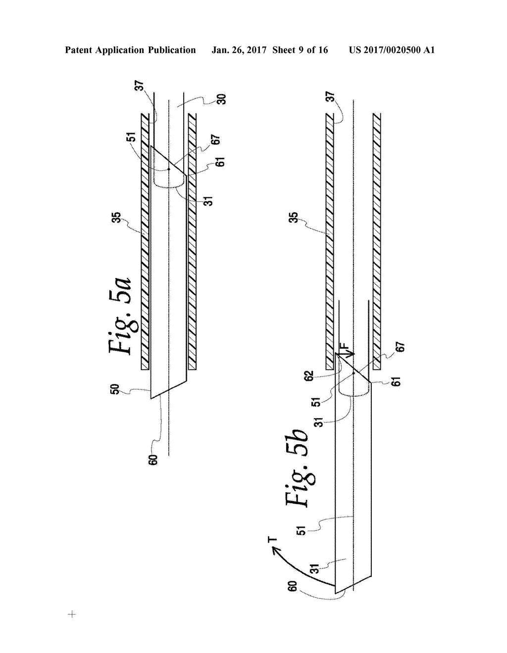 SURGICAL TISSUE RETRIEVAL INSTRUMENT AND METHOD OF USE OF A SURGICAL     TISSUE RETRIEVAL INSTRUMENT - diagram, schematic, and image 10