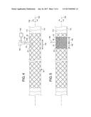 INTRODUCER SHEATH WITH BRAIDED FILAMENT SECUREMENT MECHANISM diagram and image