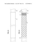 INTRODUCER SHEATH WITH BRAIDED FILAMENT SECUREMENT MECHANISM diagram and image