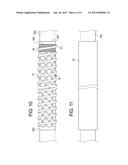 INTRODUCER SHEATH WITH BRAIDED FILAMENT SECUREMENT MECHANISM diagram and image