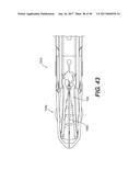 MANUAL SURGICAL LIGATION CLIP APPLIER diagram and image