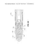 MANUAL SURGICAL LIGATION CLIP APPLIER diagram and image