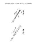 MANUAL SURGICAL LIGATION CLIP APPLIER diagram and image