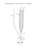 EXPANDABLE TIP ASSEMBLY FOR THROMBUS MANAGEMENT diagram and image