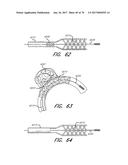 EXPANDABLE TIP ASSEMBLY FOR THROMBUS MANAGEMENT diagram and image