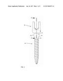 PEDICLE SCREW TULIP ASSEMBLY WITH MULTI-SEGMENTED MEMBER diagram and image