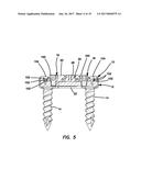 Lateral plate diagram and image