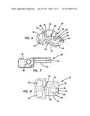 Lateral plate diagram and image