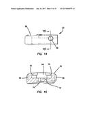 Lateral plate diagram and image