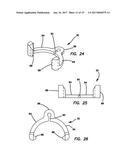 Lateral plate diagram and image