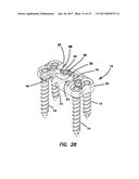 Lateral plate diagram and image