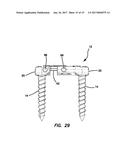 Lateral plate diagram and image