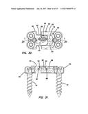 Lateral plate diagram and image