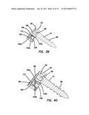 Lateral plate diagram and image