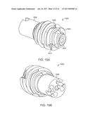 SHAPE ADAPTABLE INTRAMEDULLARY FIXATION DEVICE diagram and image